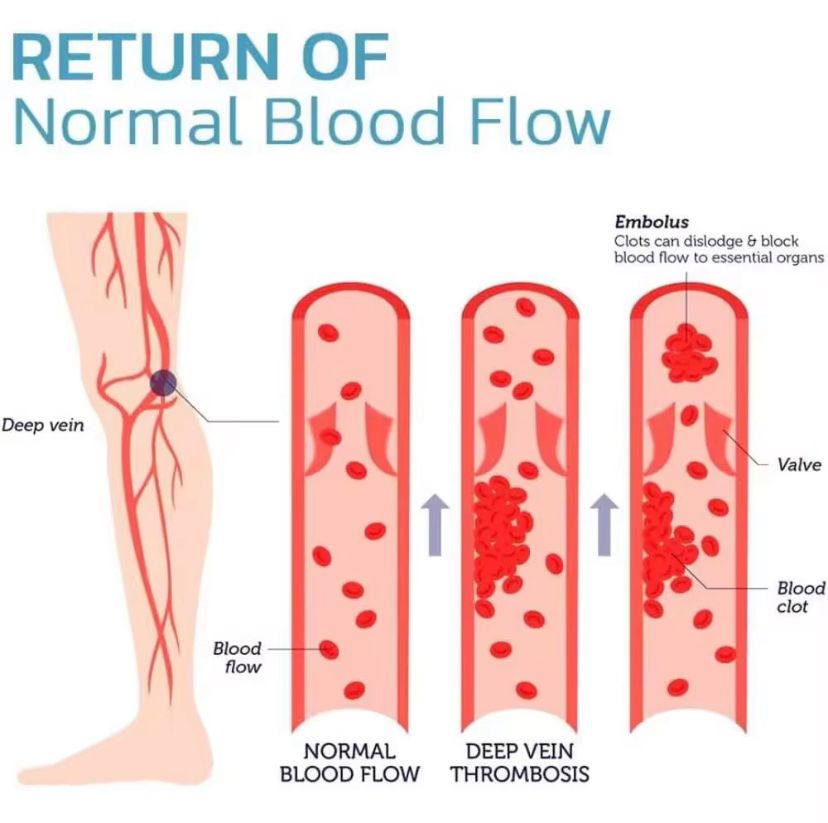 Pack of 2 Adjustable Knee Support Brace